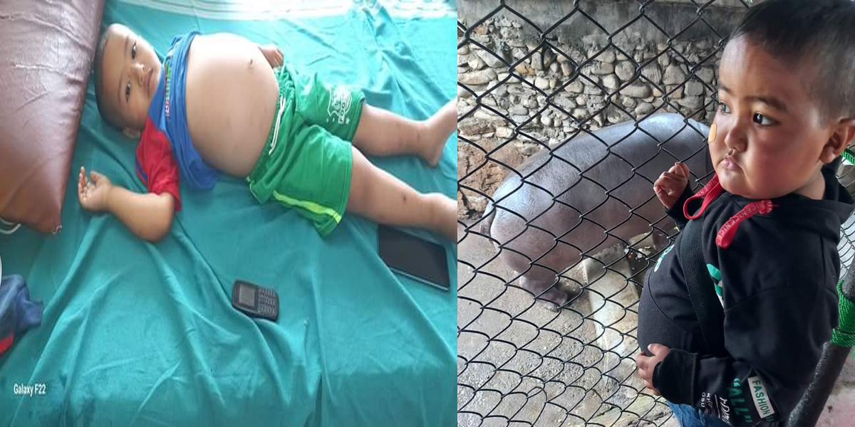 दार्चुलाको दुहुँका मृगौला पीडित बालकको उपचारका लागि आर्थिक सहयोगको अपिल