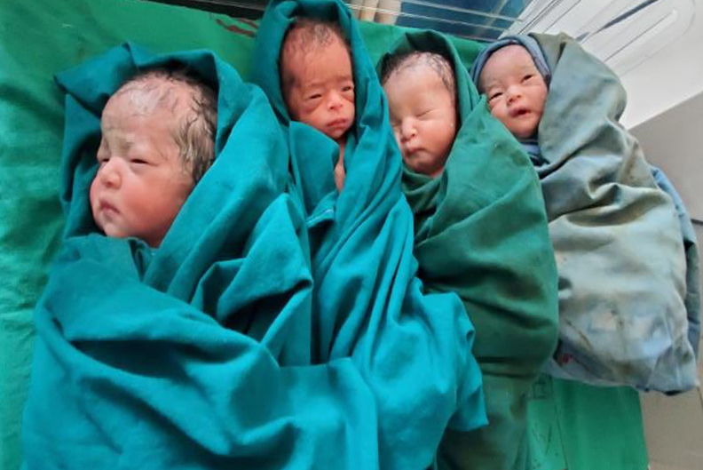पाँच शिशुलाई जन्म दिएकी आमाको स्वास्थ्य सामान्य, एक शिशुको गर्भमै मृत्यु