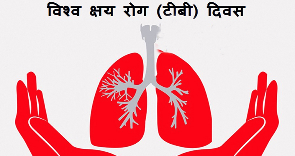 विश्व क्षयरोग दिवस : ४१ हजार क्षयरोगी अझै उपचारबाहिर