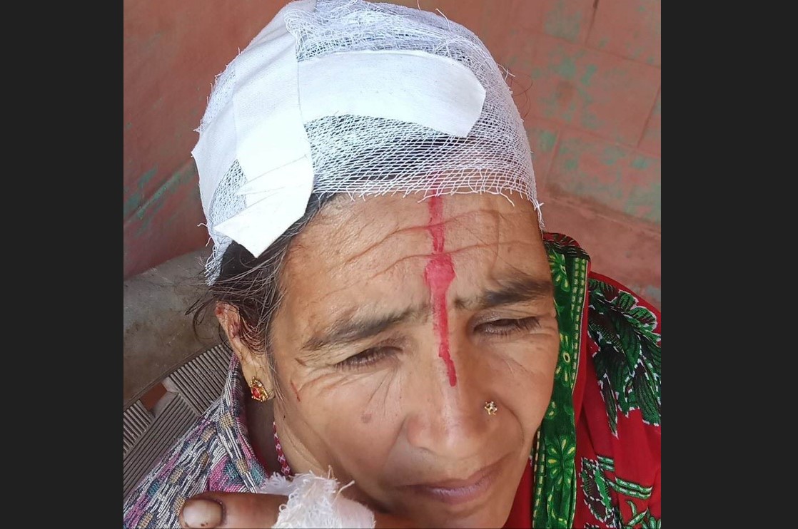 बैतडीमा बाँदरको आक्रमणबाट महिला घाइते