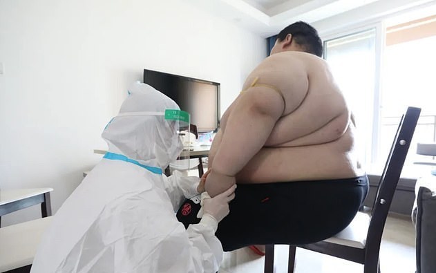वुहानका २६ वर्षीय युवकको तौल बढेर २८० किलो पुग्यो, चिकित्सक आश्चर्यचकित !